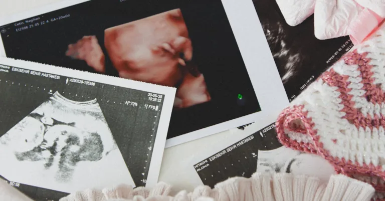 informations essentielles sur la fausse couche : causes, symptômes, prévention et soutien émotionnel pour accompagner les femmes concernées.
