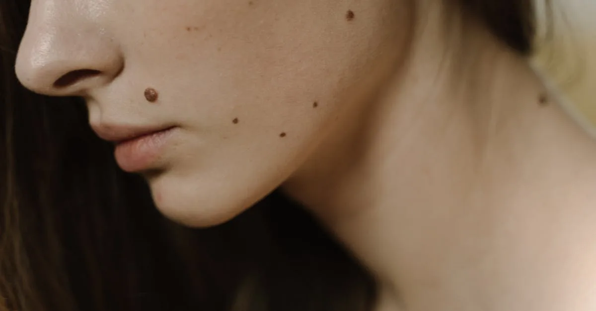 découvrez la thermocoagulation, une technique médicale utilisée pour traiter diverses affections en utilisant la chaleur pour coaguler les tissus, favorisant ainsi la guérison et réduisant les symptômes.